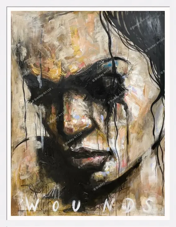 "Wounds"