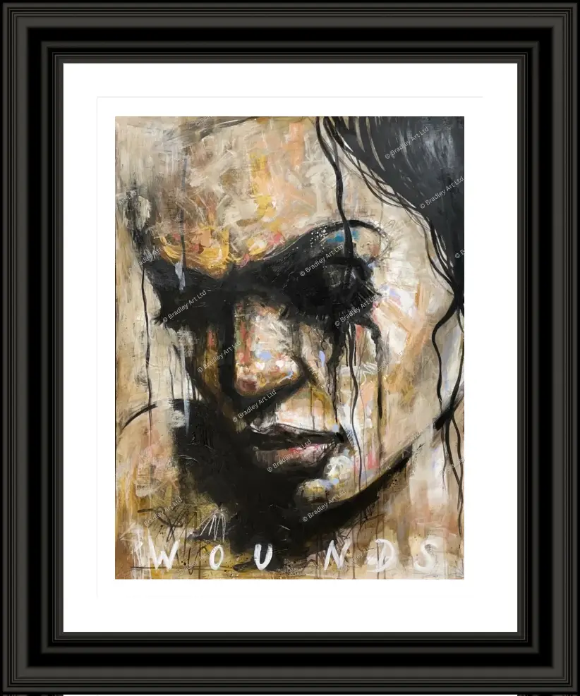 "Wounds"