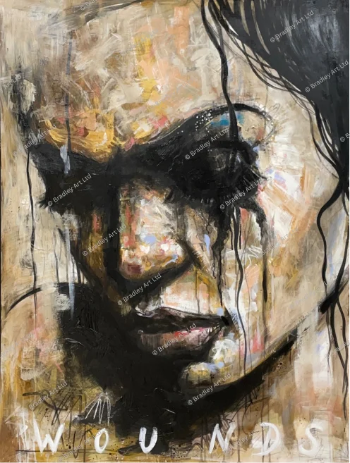 "Wounds"